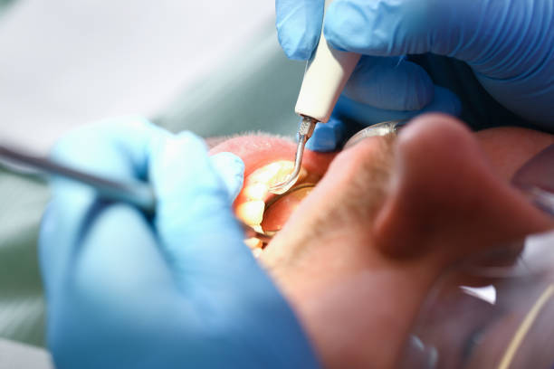 Best Emergency Gum Pain Relief  in Idabel, OK