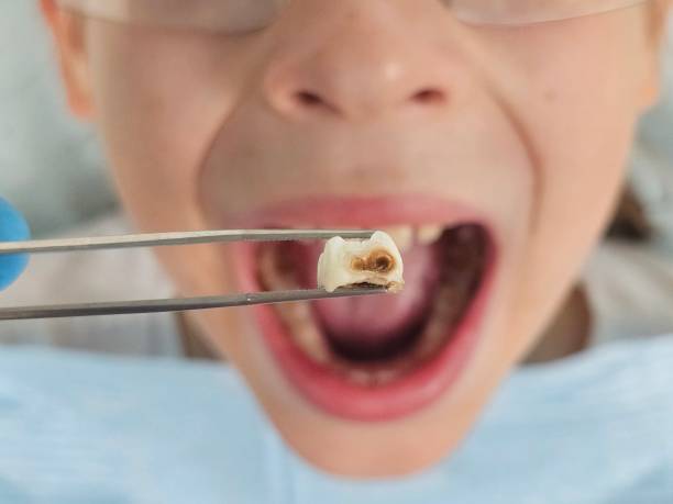 Emergency Dentist for Kids in OK